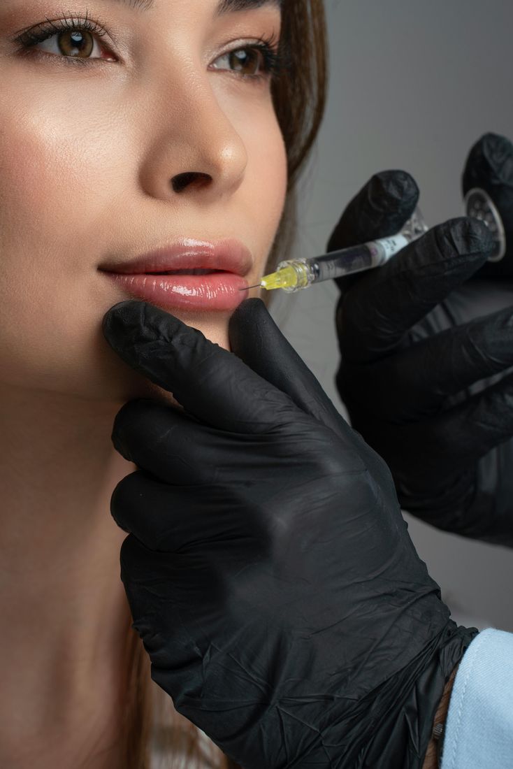 Ácido hialurónico en Angel Medical Aesthetic