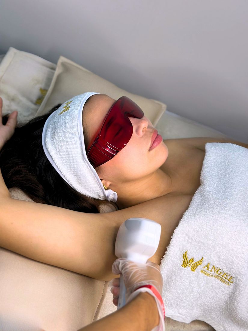 Depilación láser en Angel Medical Aesthetic