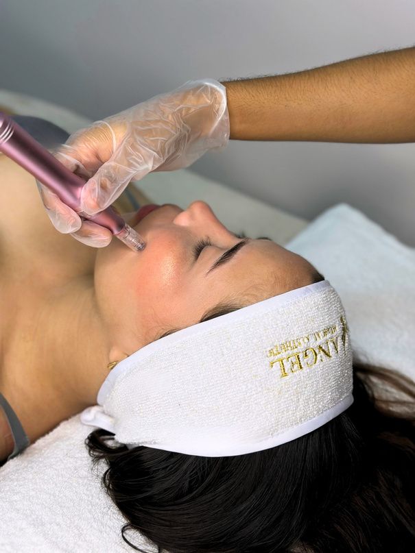 Dermapen en Angel Medical Aesthetic