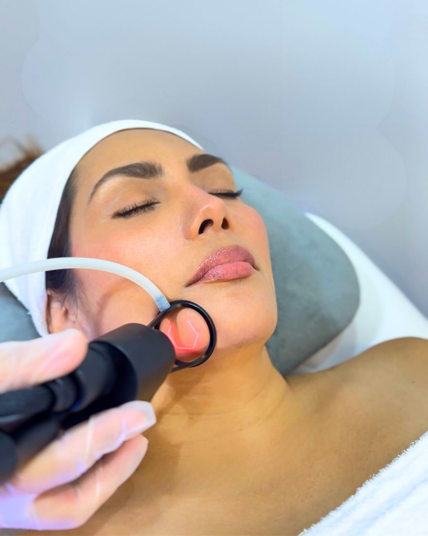 Regenera Lift en Angel Medical Aesthetic